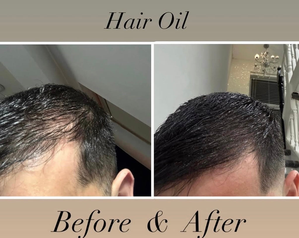 Root Revival Hair Oil