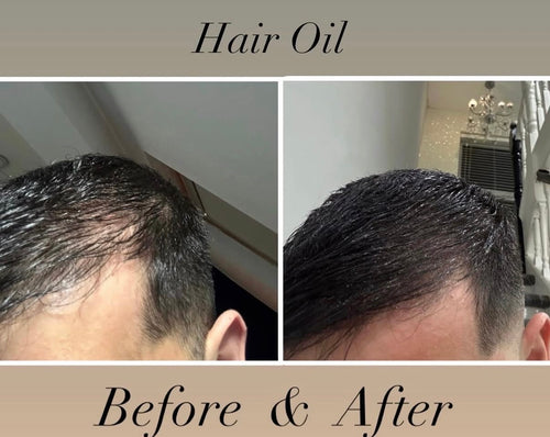 PREORDER - Root Revival Hair Oil
