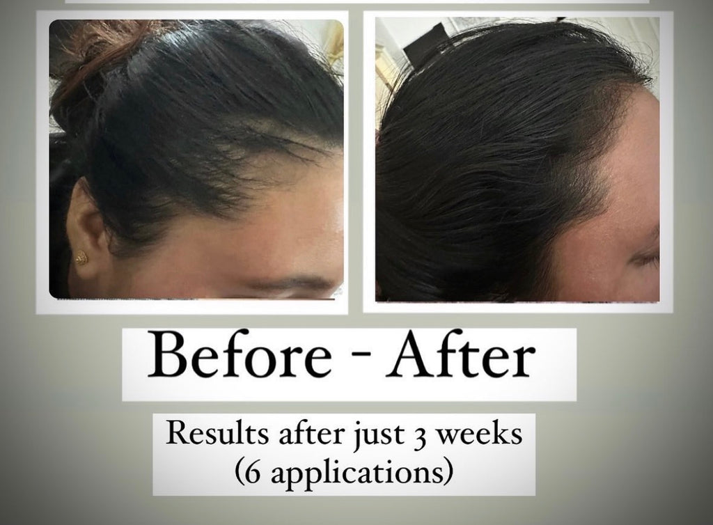 Root Revival Hair Oil