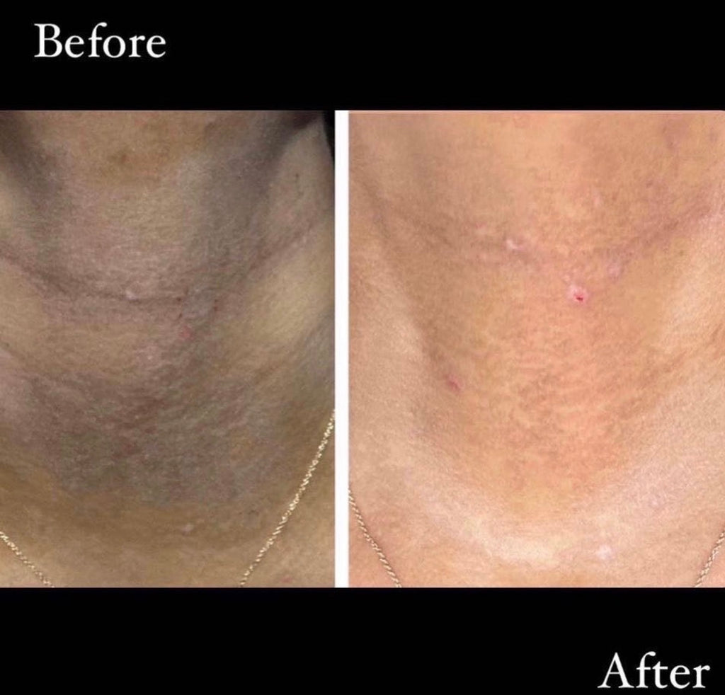 Brightening clay mask